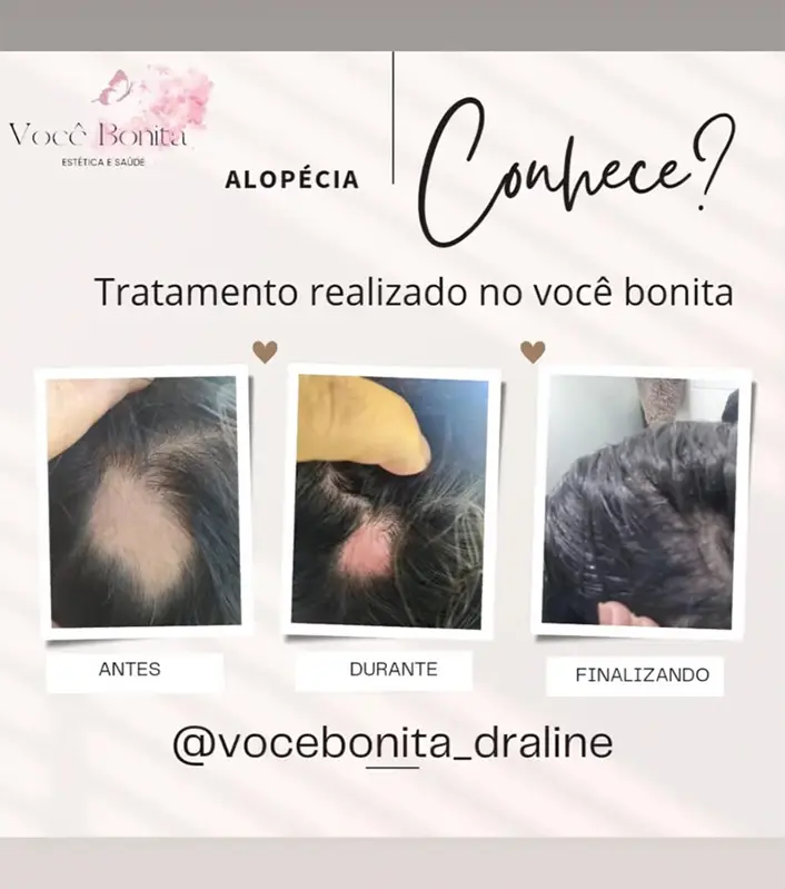 Resultado real Instituto Você Bonita 2