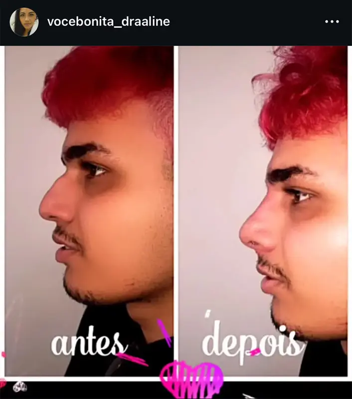 Resultado real Instituto Você Bonita 3