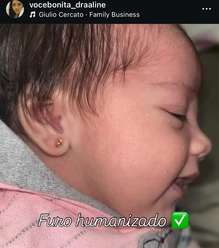 Resultado real Instituto Você Bonita 4
