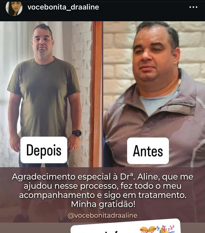 Resultado real Instituto Você Bonita 5